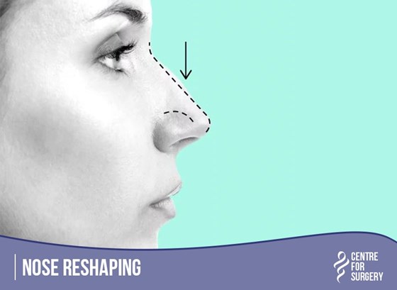 Cosmetic Surgery and Other Option: SURGERY OF THE FACE