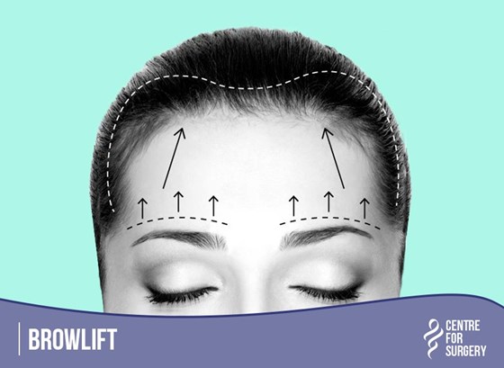 Cosmetic Surgery and Other Option: SURGERY OF THE FACE