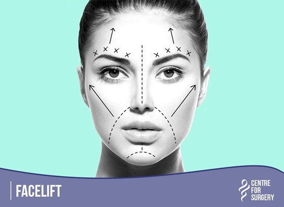 Cosmetic Surgery and Other Option: SURGERY OF THE FACE