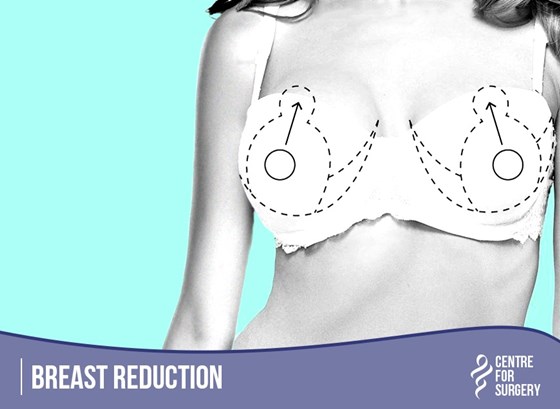 Cosmetic Surgery and Other Option: SURGERY OF THE BREAST