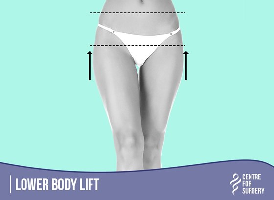 Cosmetic Surgery and Other Option: SURGERY OF THE BODY