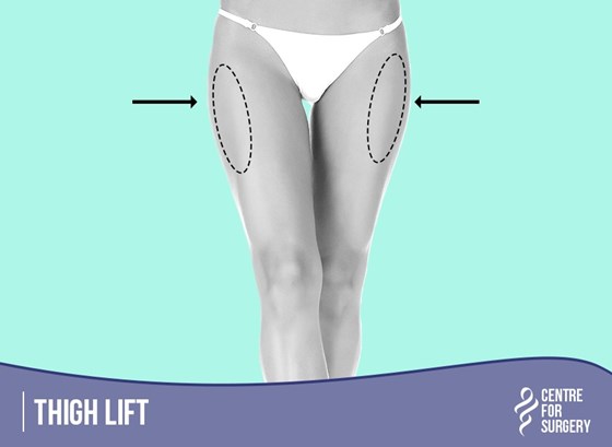 Cosmetic Surgery and Other Option: SURGERY OF THE BODY