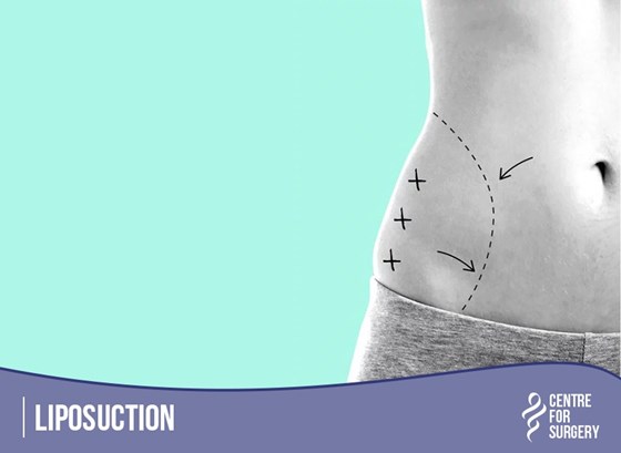 Cosmetic Surgery and Other Option: PROCEDURES FOR MEN