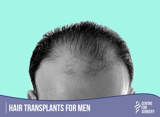 Cosmetic Surgery and Other Option: HAIR RESTORATION SURGERY