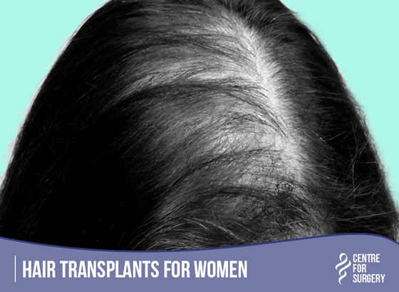 Cosmetic Surgery and Other Option: HAIR RESTORATION SURGERY